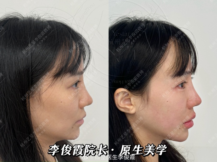 眉眼直播苹果版苹果直播app电脑下载